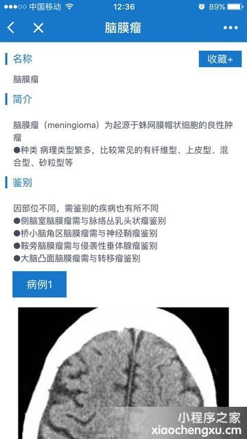 微信小程序,二维码